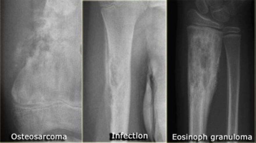 Introduction To Orthopaedics - Critical Care Collaborative